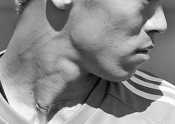 本田圭佑がレーシック手術失敗？病院広告に登場！ image 2